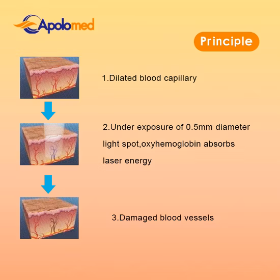 Оборудование для красоты кожи Мини-сапфировое ледяное лазерное устройство для удаления волос IPL